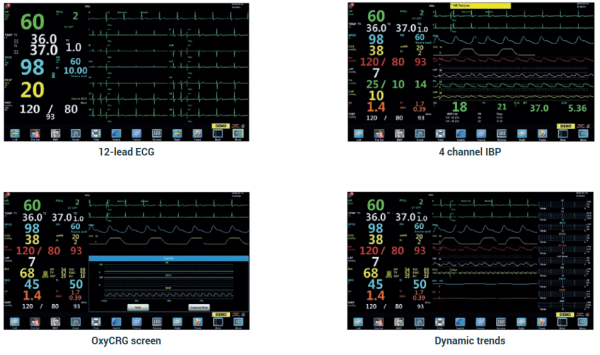 Monitor Cetus X15 axcent